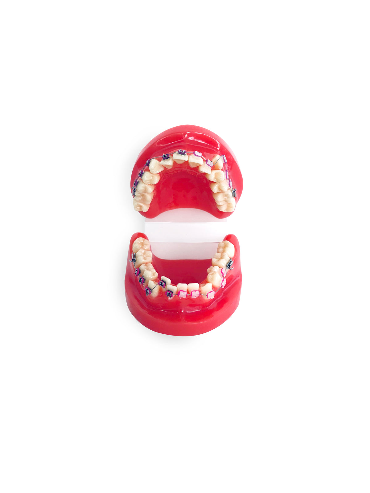 Ortho Dental Tooth Model With Brace, fourth view