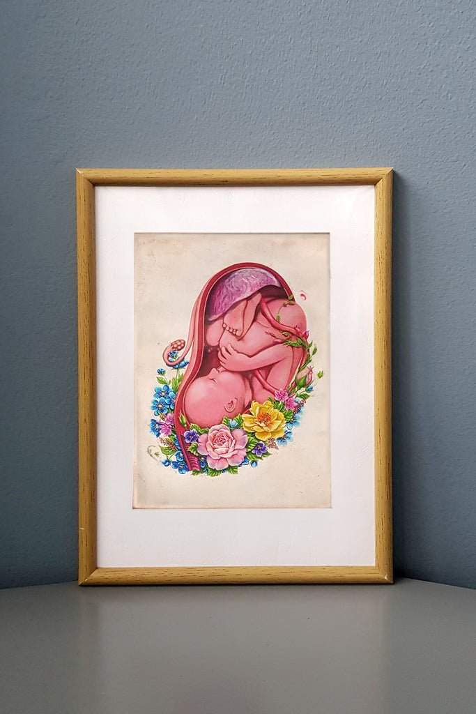 Placenta Flower Anatomy - Framed Medical Art