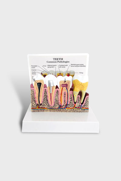 Dental Tooth Demonstration Model