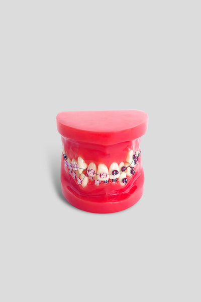 Ortho Dental Tooth Model With Brace