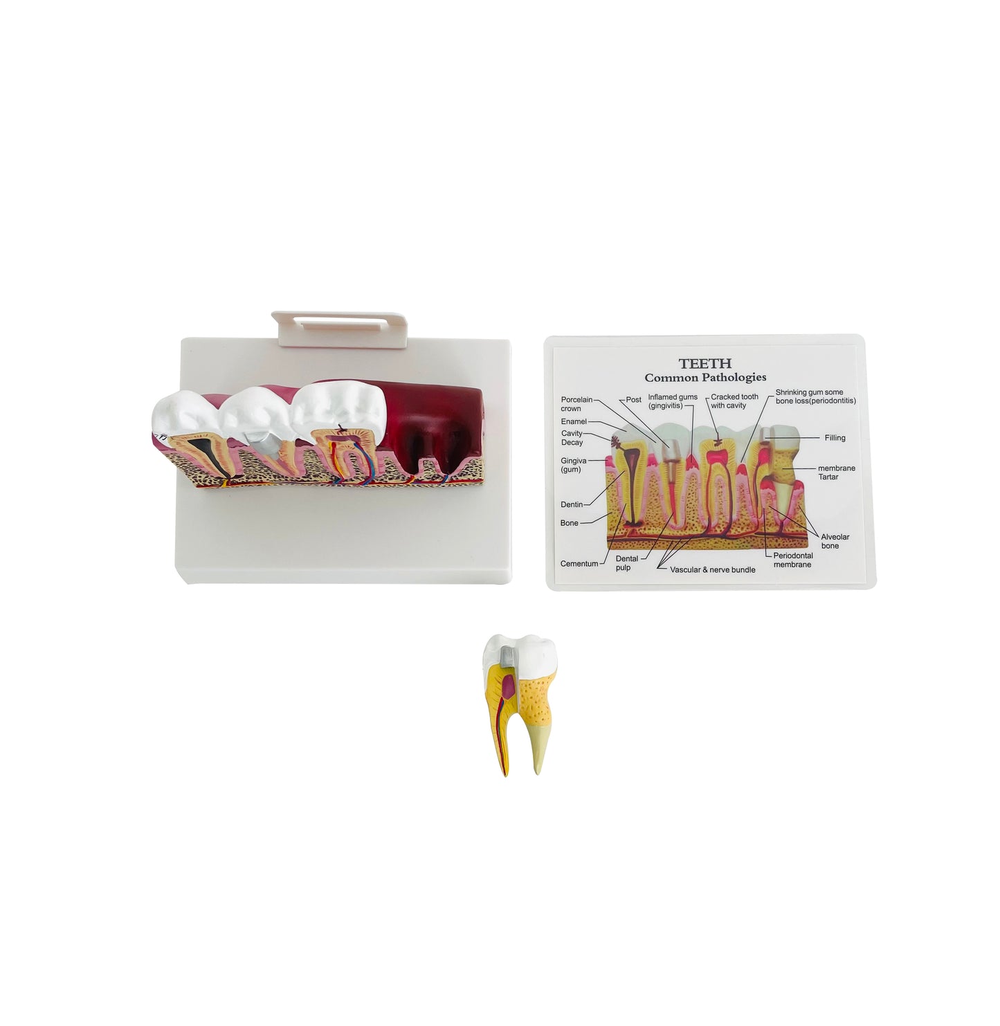 Dental Tooth Demonstration Model
