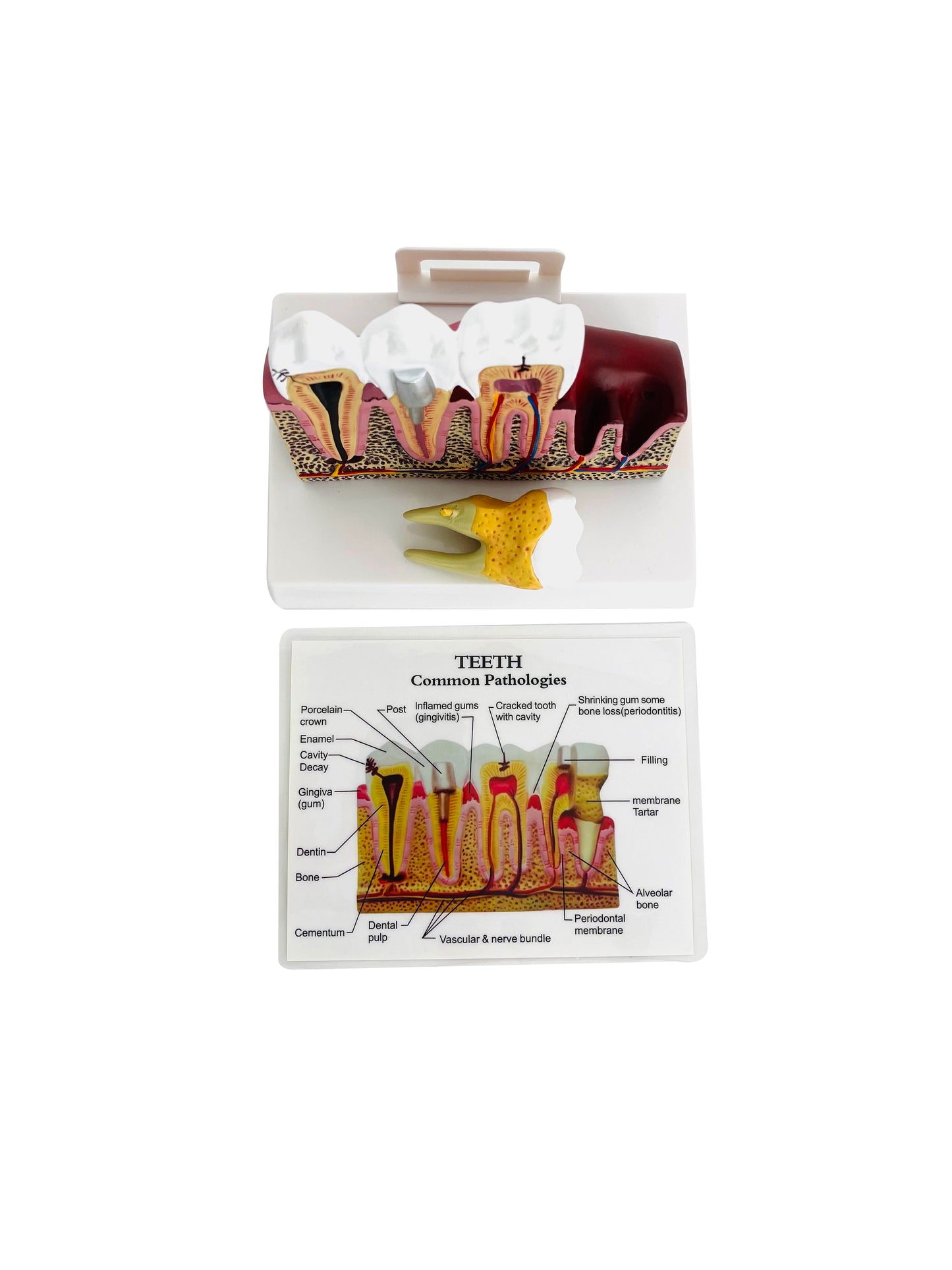 Dental Tooth Demonstration Model