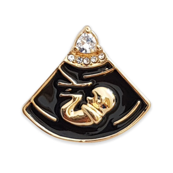 ULTRASOUND PIN