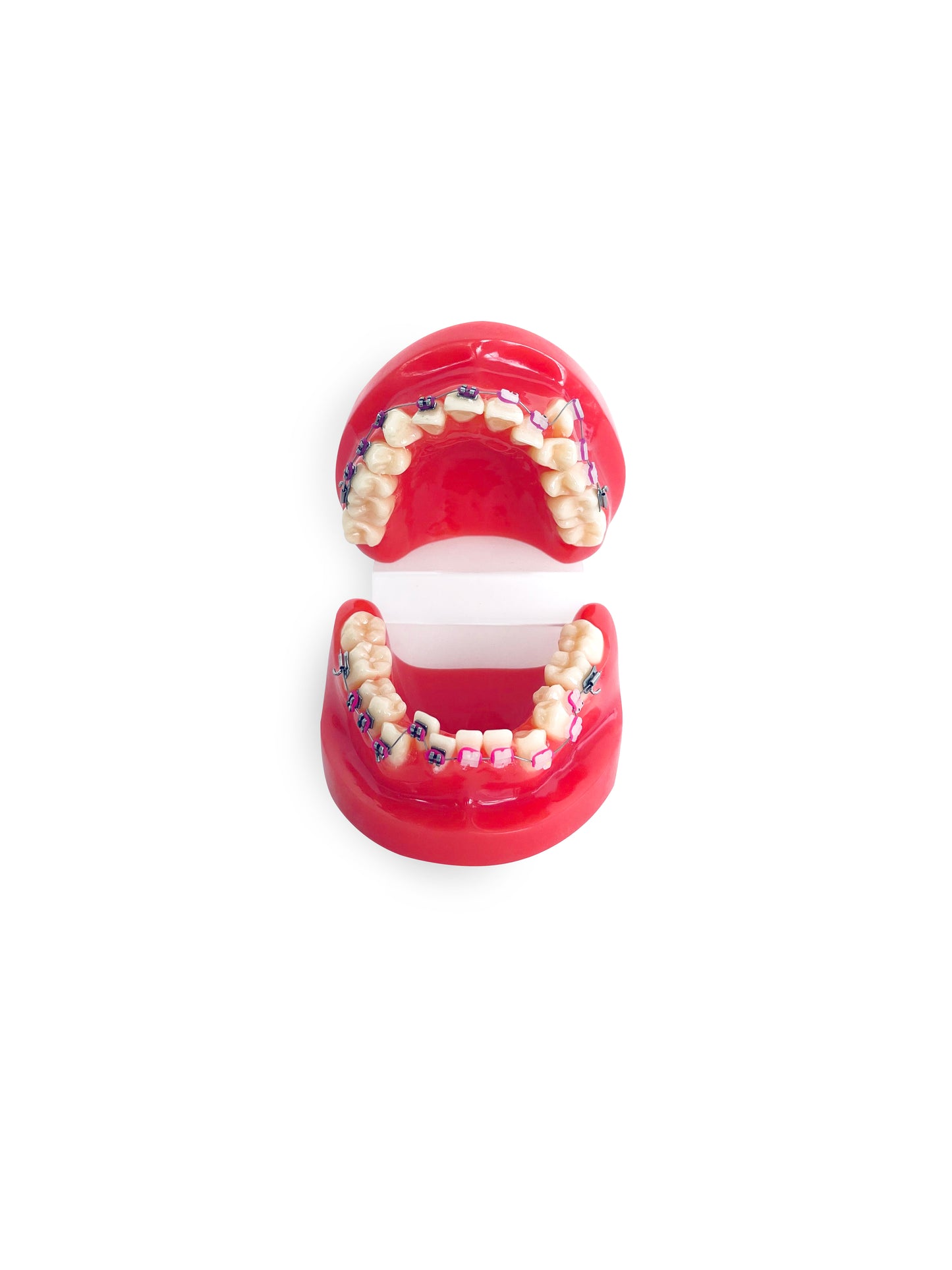 Ortho Dental Tooth Model With Brace