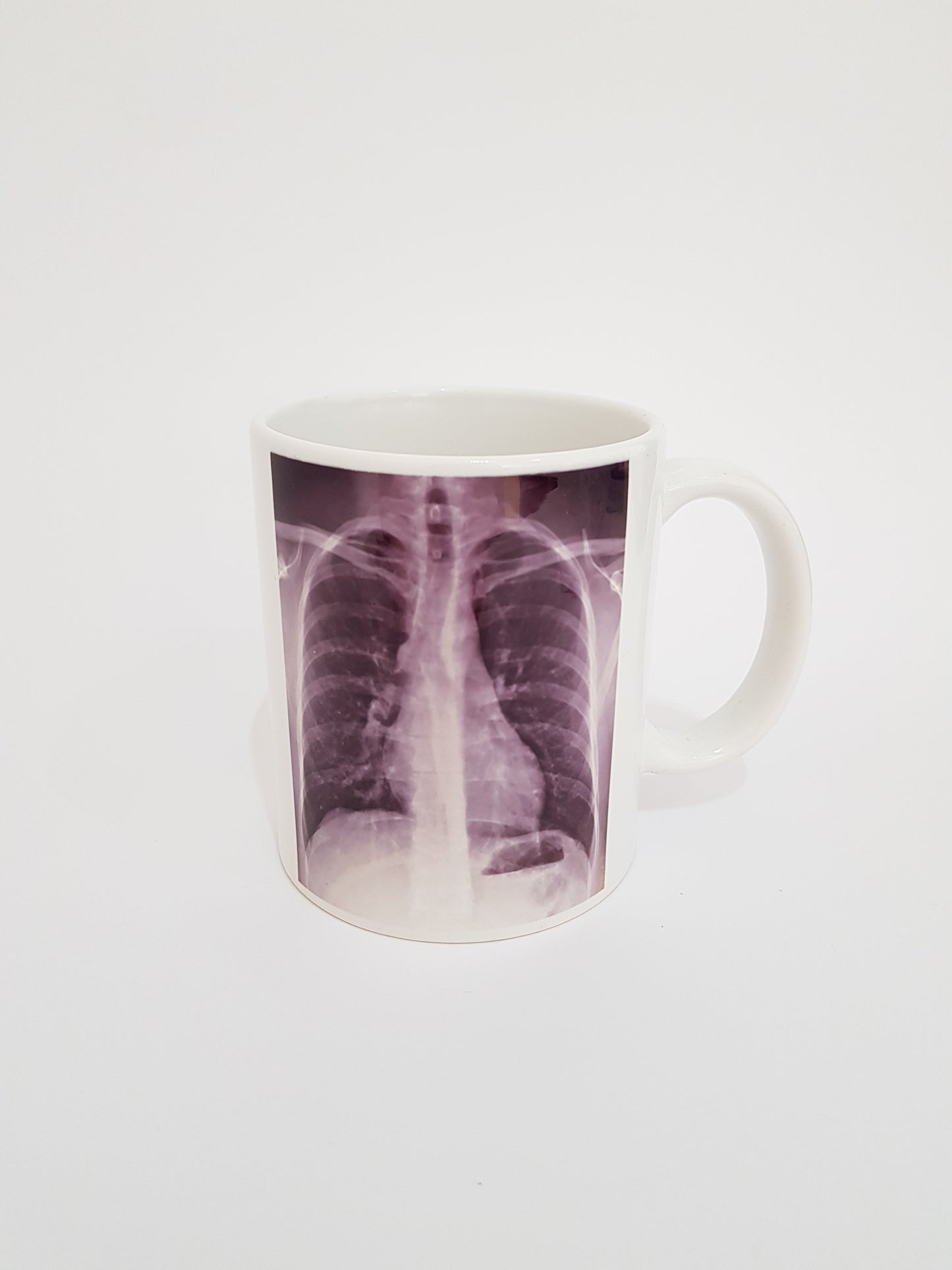 X-Ray Ceramic Coffee Mug