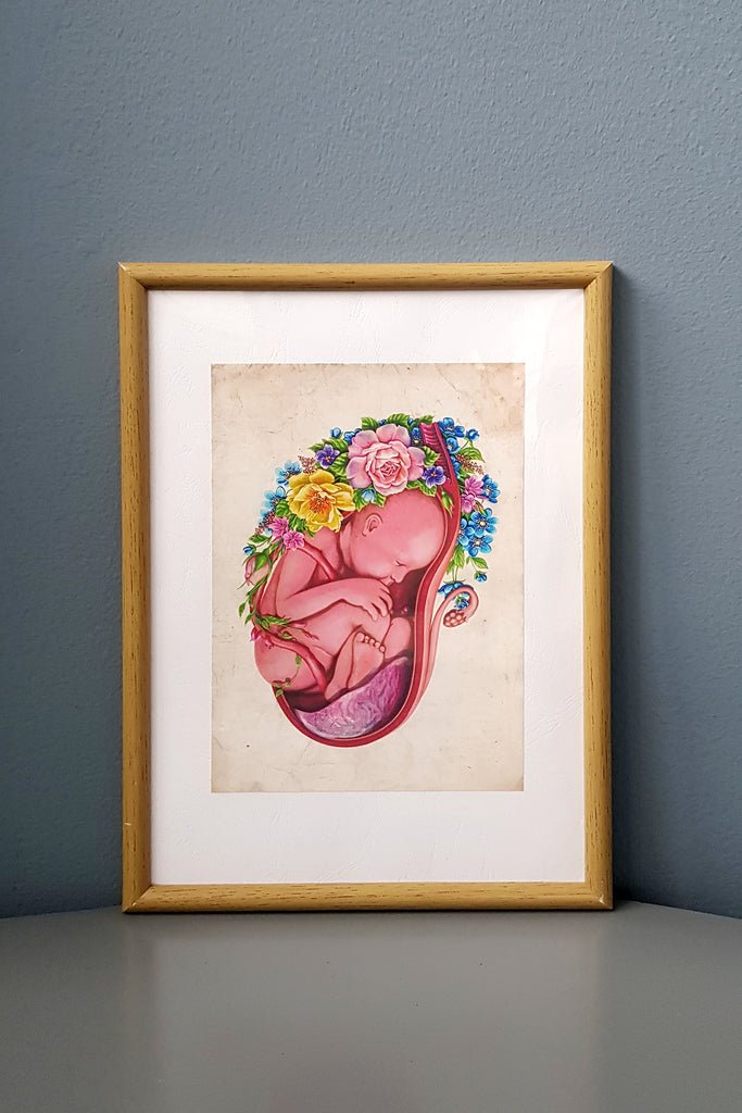 Placenta Flower Anatomy - Framed Medical Art