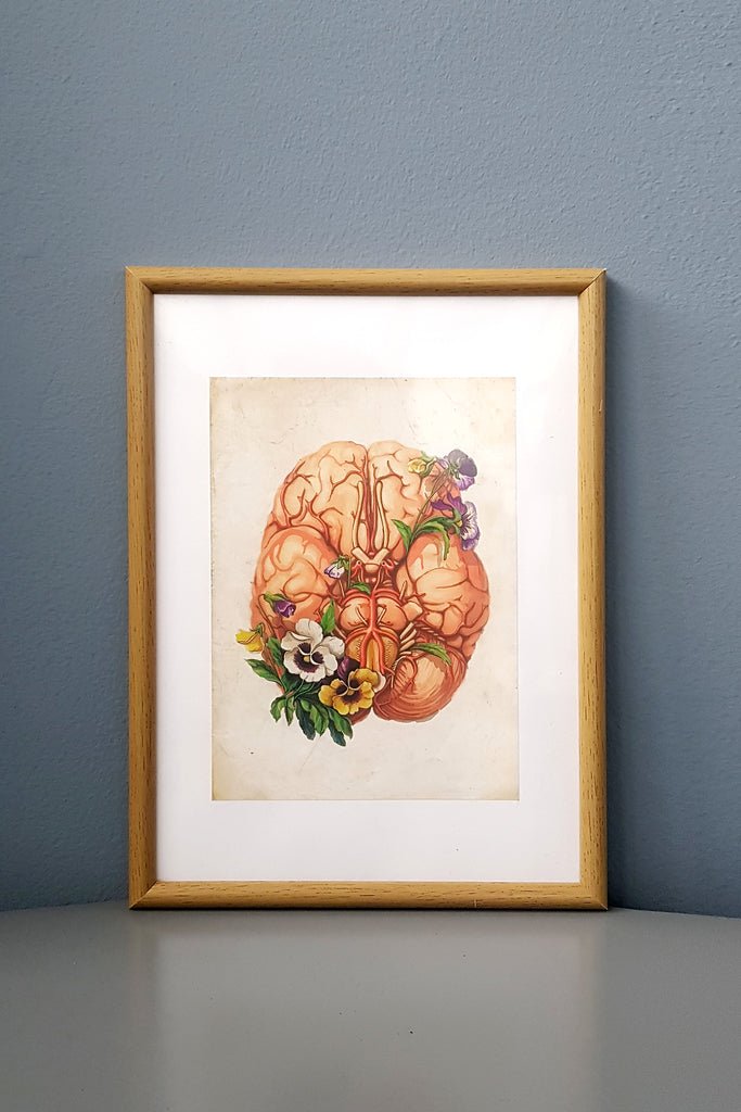 Brain Flower Anatomy - Framed Medical Art