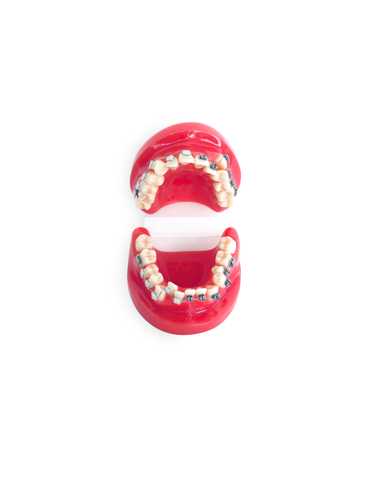 Ortho Dental Tooth Model With Brace, third view